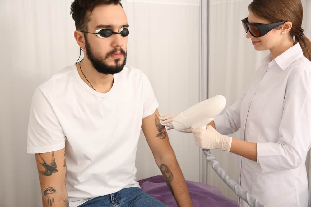 Young Man Undergoing Laser Tattoo Removal Procedure